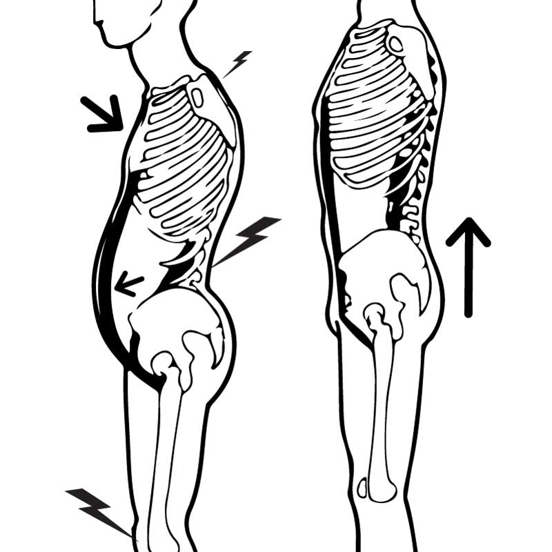 Rückenschmerzen sind oft Resultat myofaszialer Dysbalancen 