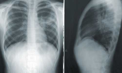Auf einer Röntgenaufnahme, einem CT- oder MRT-Bild sind Verspannungen nicht sichtbar